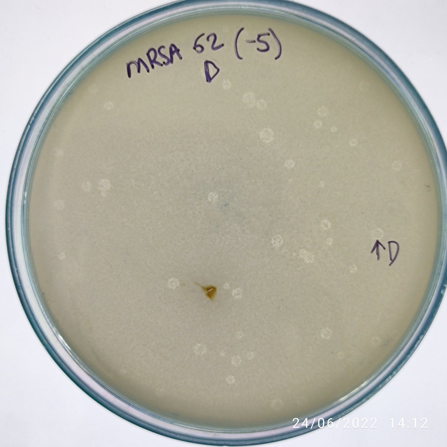 Staphylococcus aureus bacteriophage 150062D