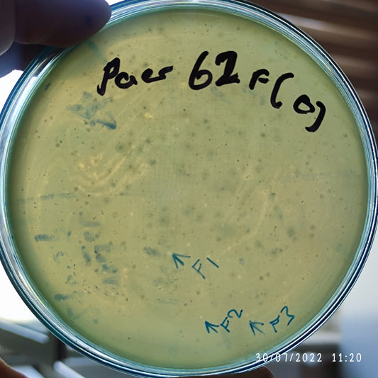 Pseudomonas aeruginosa bacteriophage 130062F