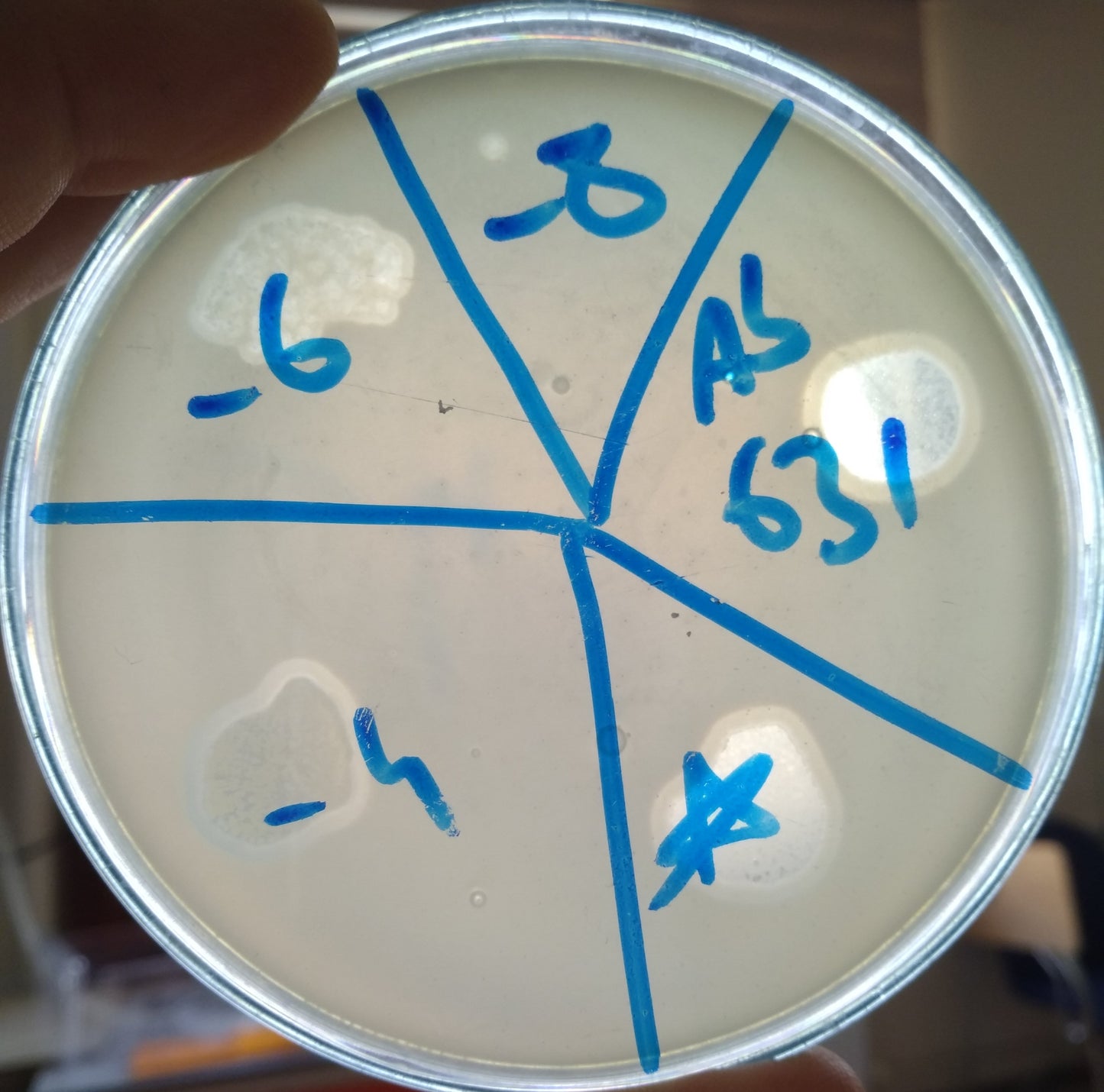 Acinetobacter baumannii bacteriophage 120631A