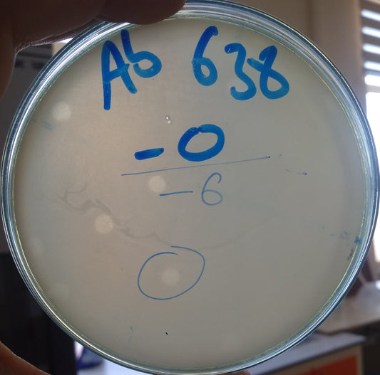 Acinetobacter baumannii bacteriophage 120638A