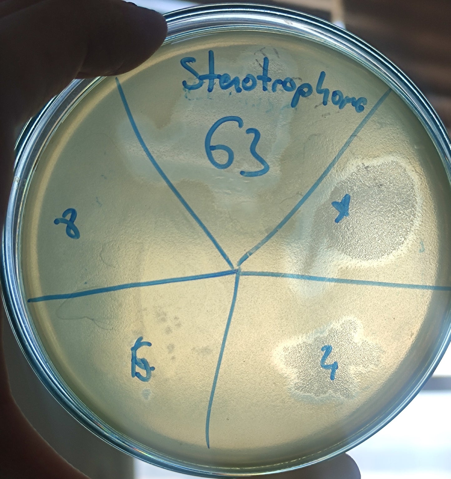 Stenotrophomonas maltophilia bacteriophage 200063D