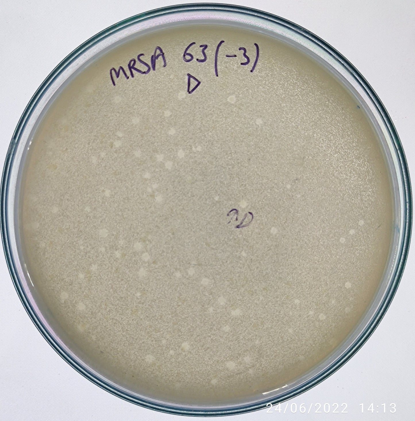 Staphylococcus aureus bacteriophage 150063D