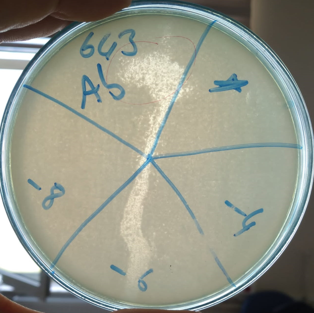 Acinetobacter baumannii bacteriophage 120643A