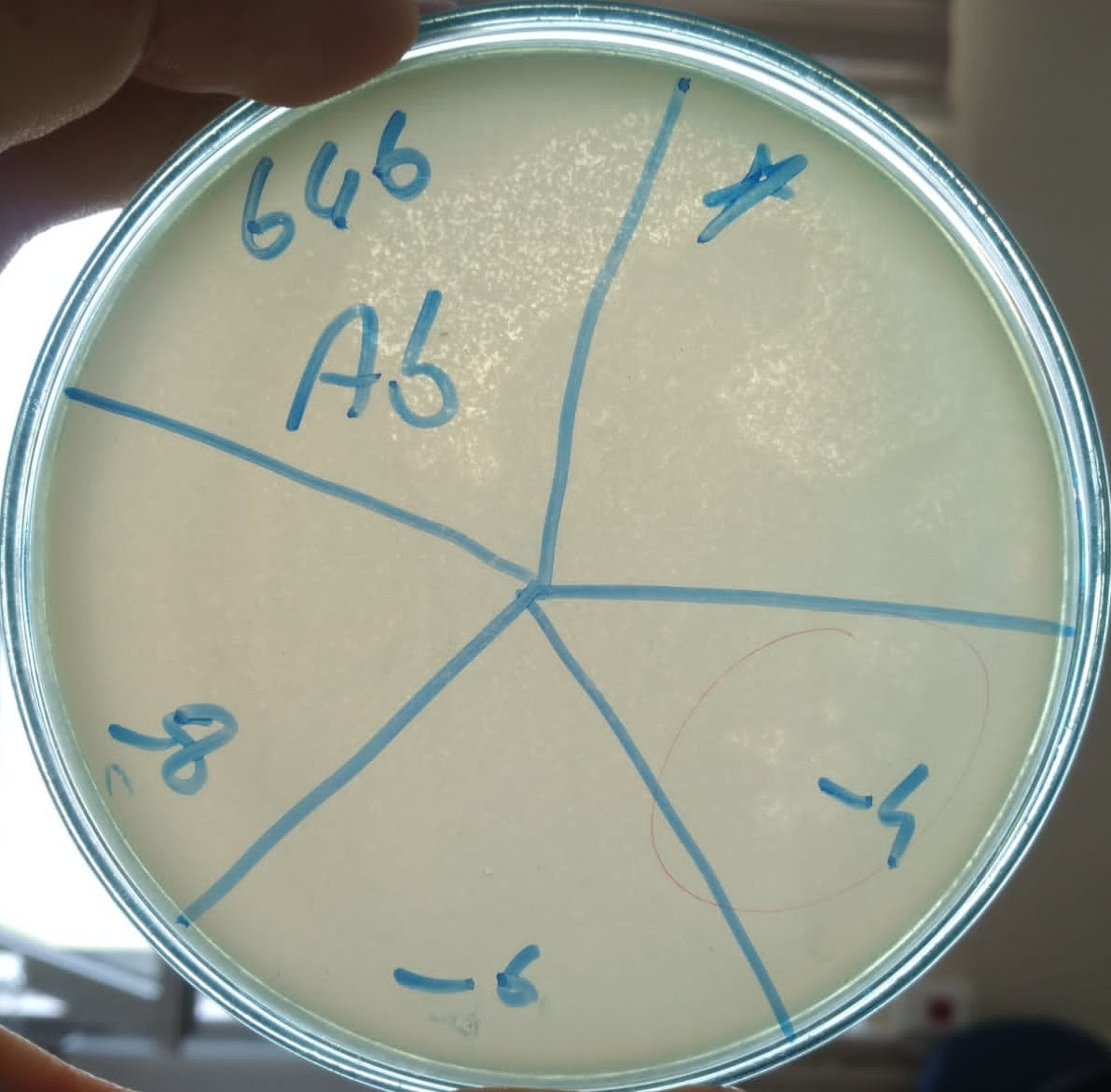 Acinetobacter baumannii bacteriophage 120646A