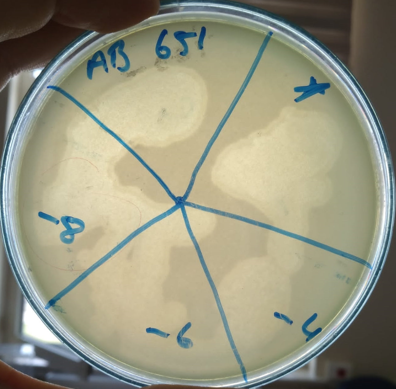 Acinetobacter baumannii bacteriophage 120651A