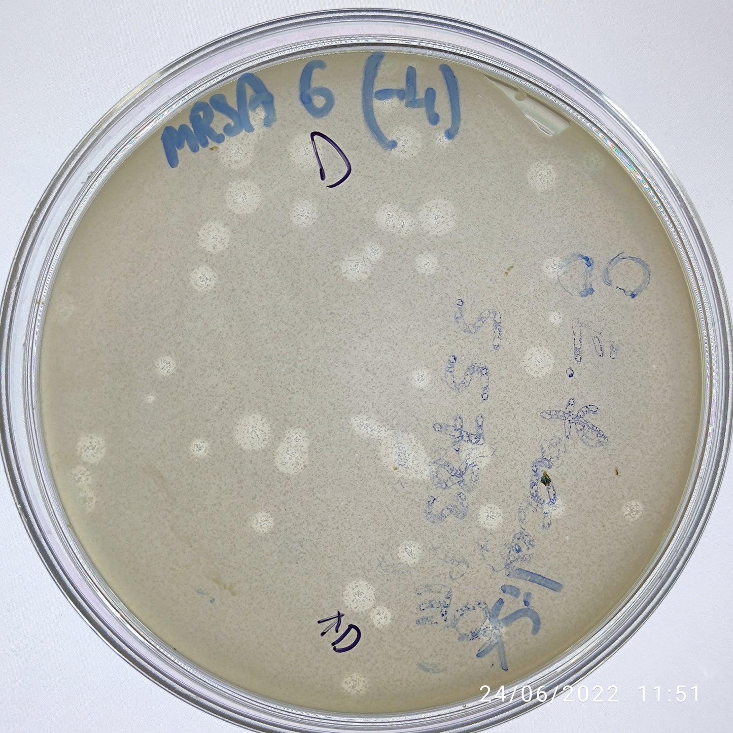 Staphylococcus aureus bacteriophage 150006D