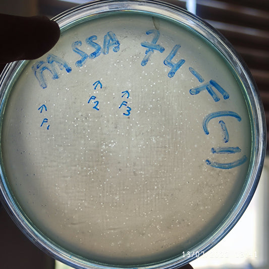 Staphylococcus aureus bacteriophage 152074F