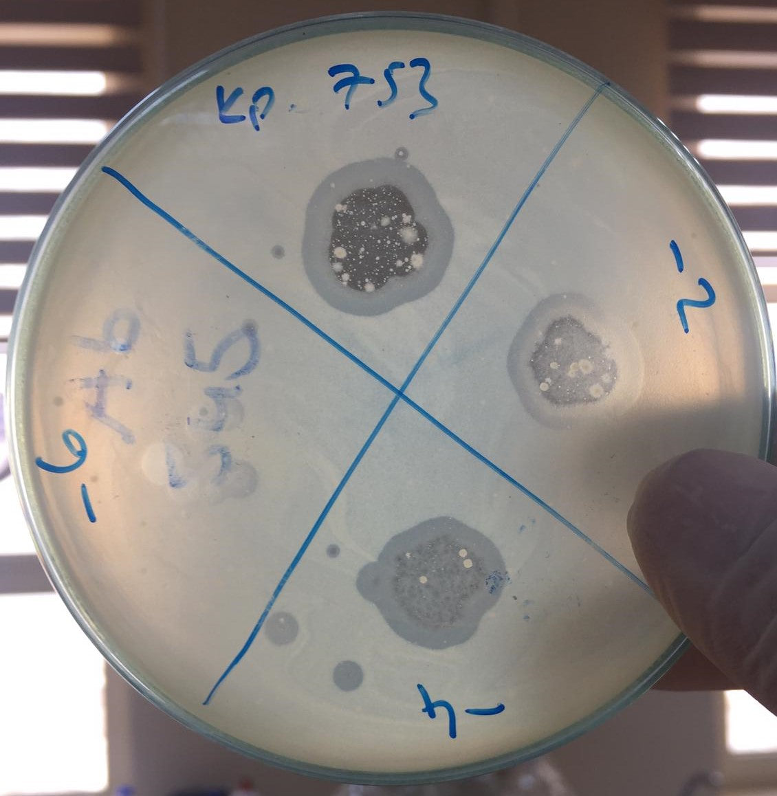 Klebsiella pneumoniae bacteriophage 180753A