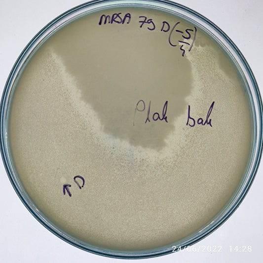 Staphylococcus aureus bacteriophage 150079D