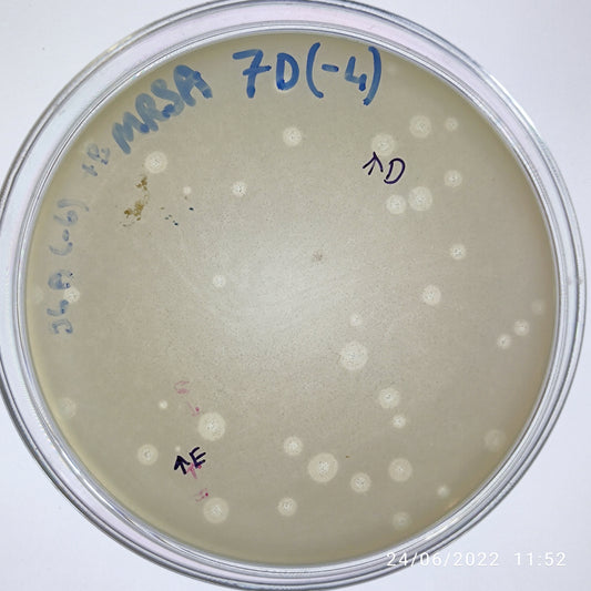 Staphylococcus aureus bacteriophage 150007E
