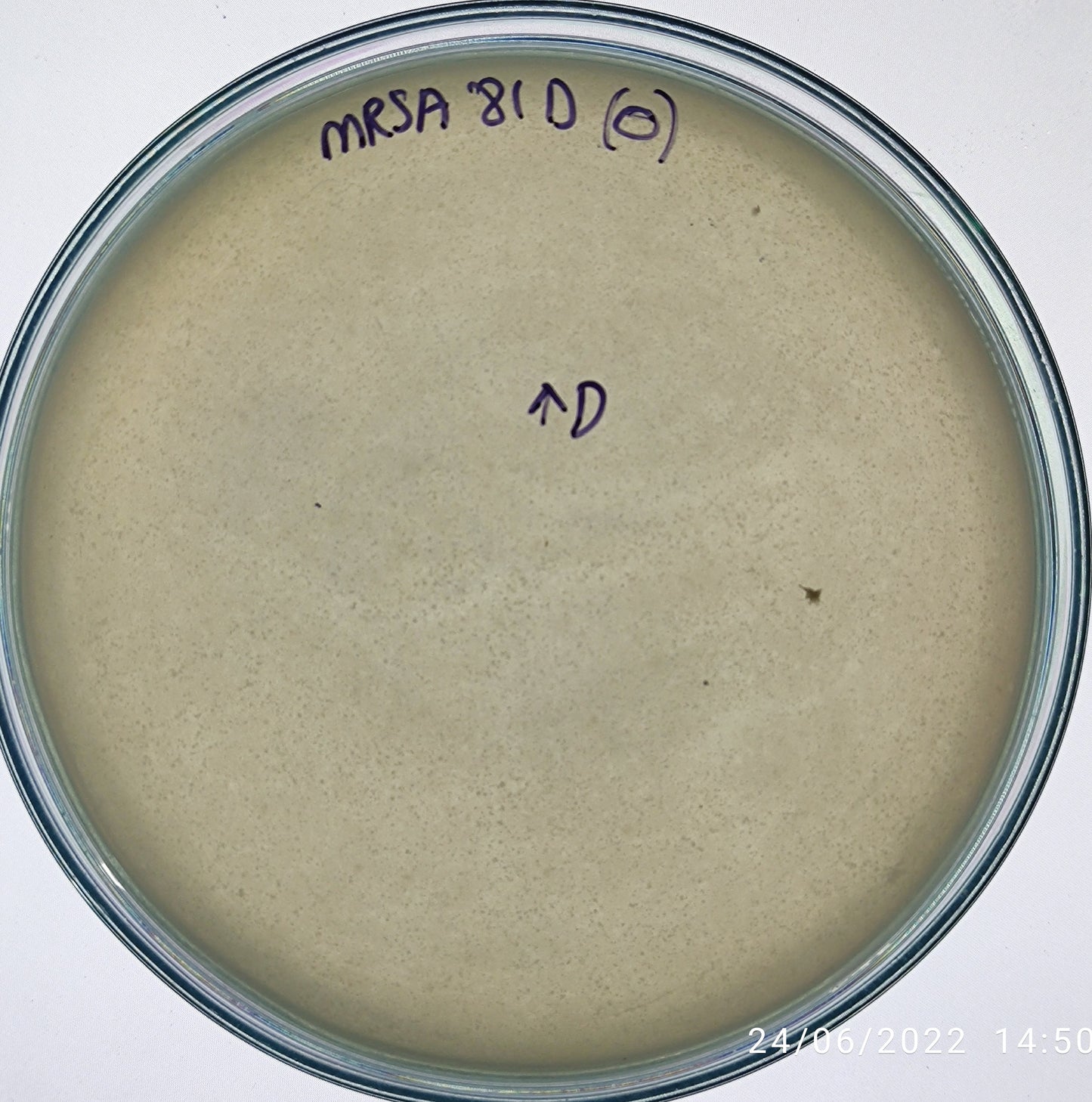 Staphylococcus aureus bacteriophage 150081D