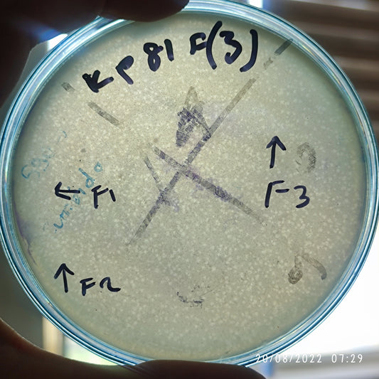 Klebsiella pneumoniae bacteriophage 180081F