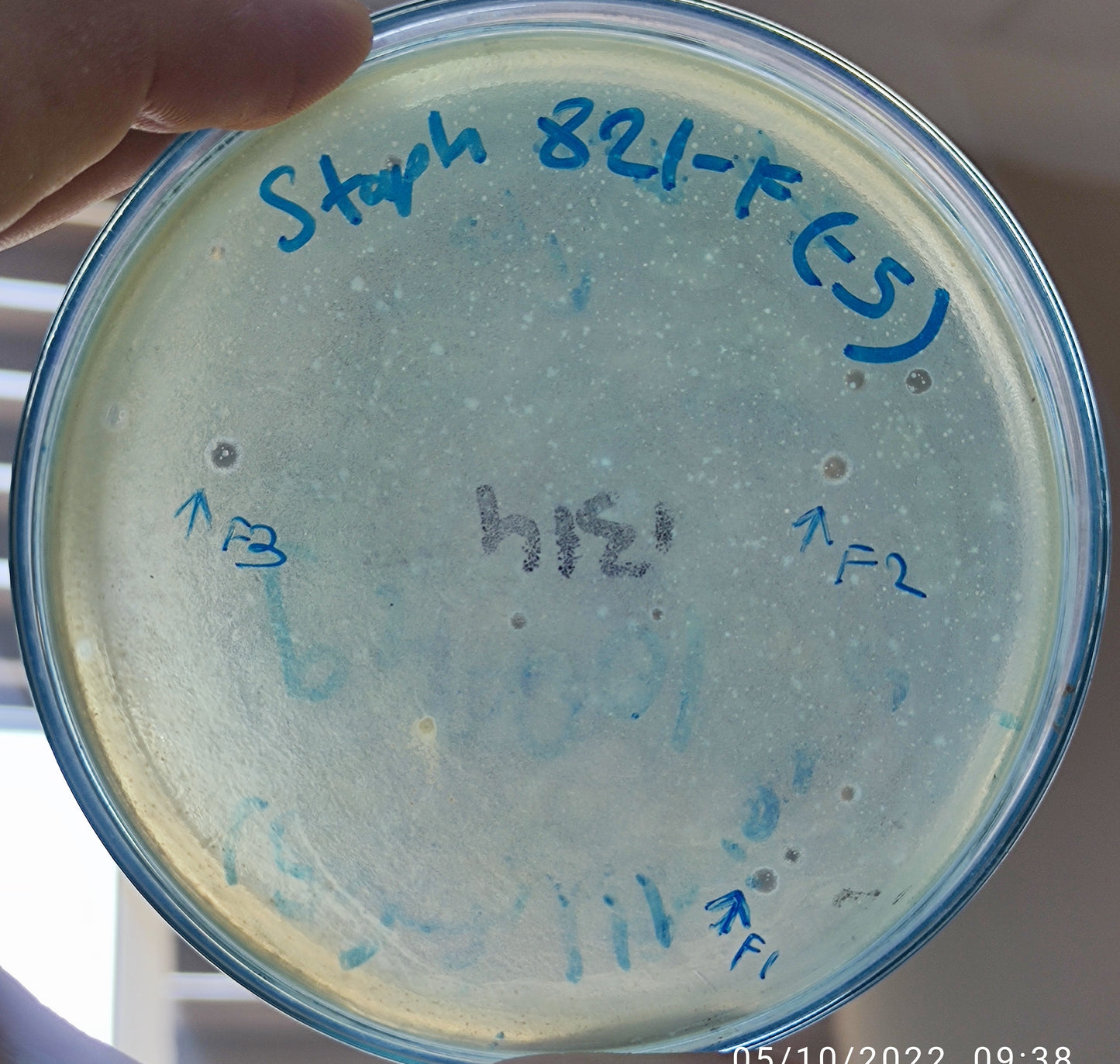 Staphylococcus aureus bacteriophage 152821F