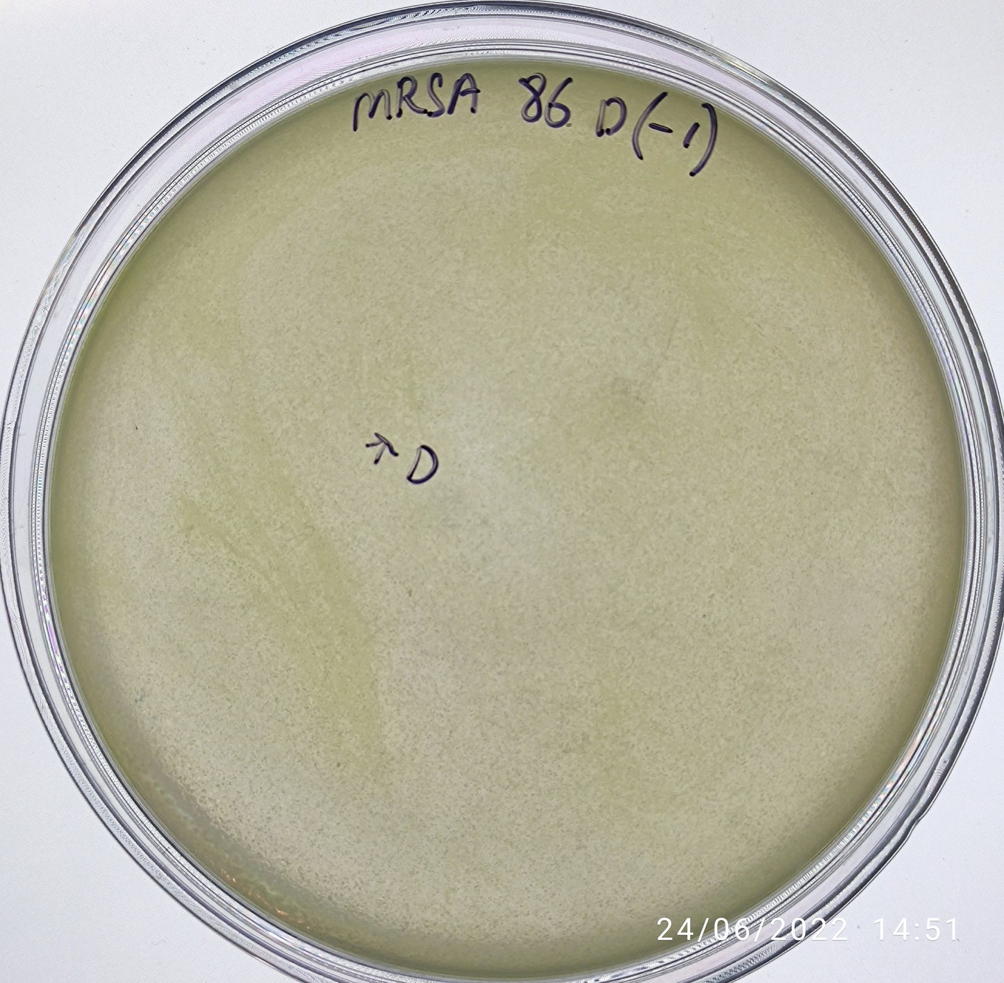 Staphylococcus aureus bacteriophage 150086D