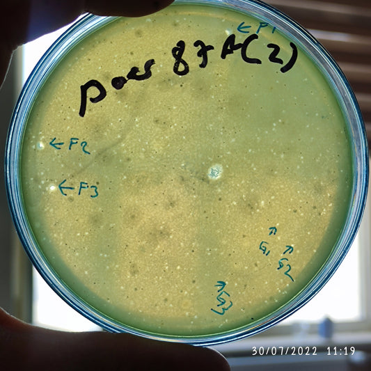 Pseudomonas aeruginosa bacteriophage 130087F