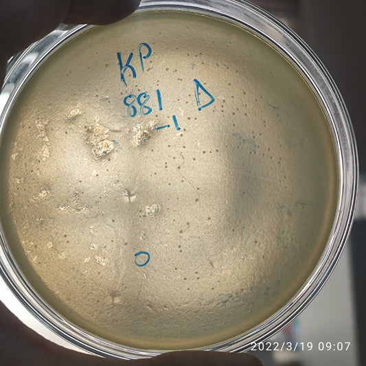 Klebsiella pneumoniae bacteriophage 180881D