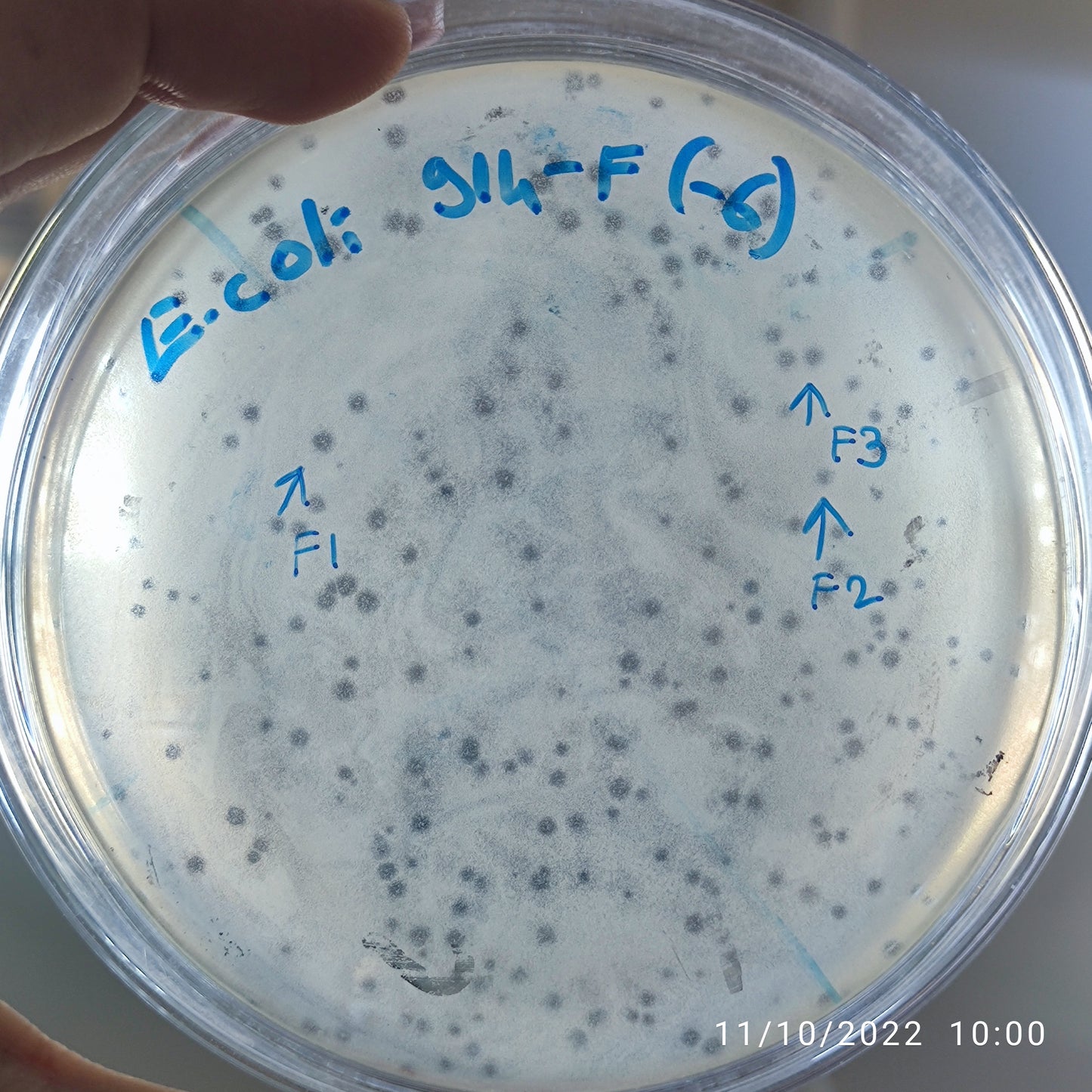 Escherichia coli bacteriophage 100914F