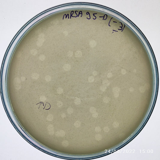 Staphylococcus aureus bacteriophage 150095D