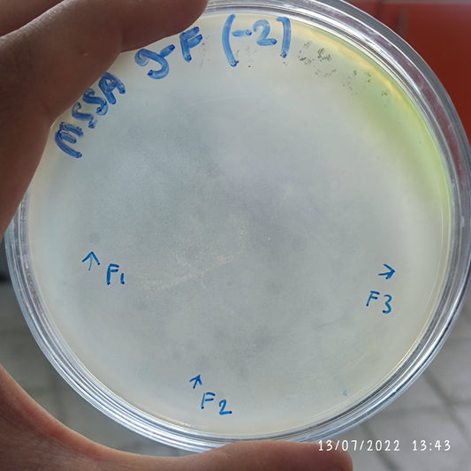 Staphylococcus aureus bacteriophage 152009F