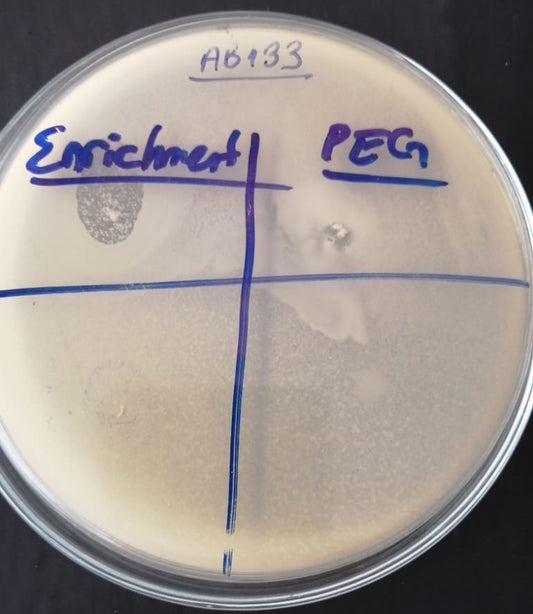 Acinetobacter baumannii bacteriophage 120133A
