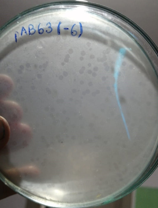 Acinetobacter baumannii bacteriophage 120063A