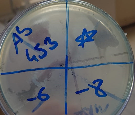 Acinetobacter baumannii bacteriophage 120453B