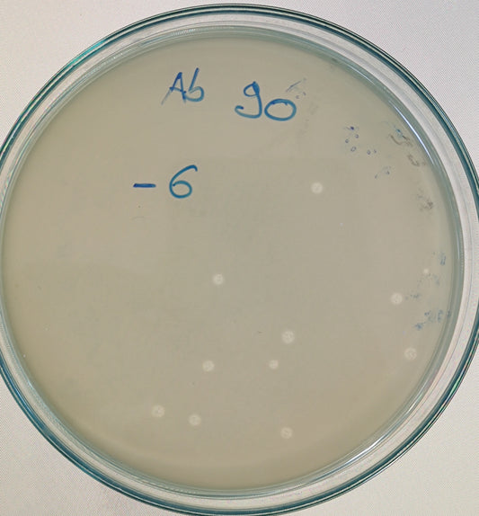Acinetobacter baumannii bacteriophage 120090A