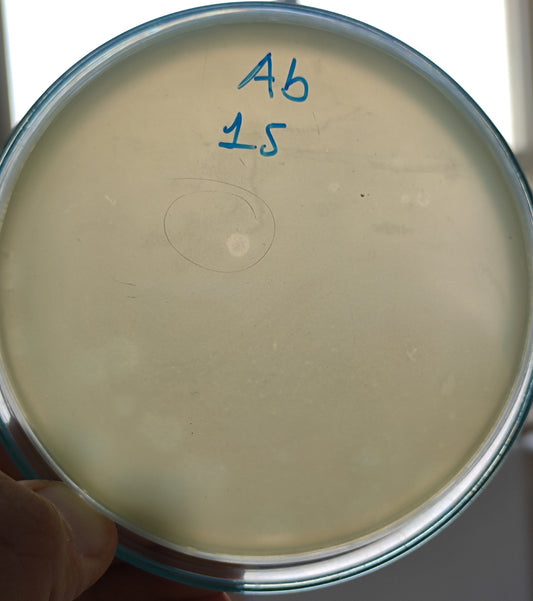 Acinetobacter baumannii bacteriophage 120015A