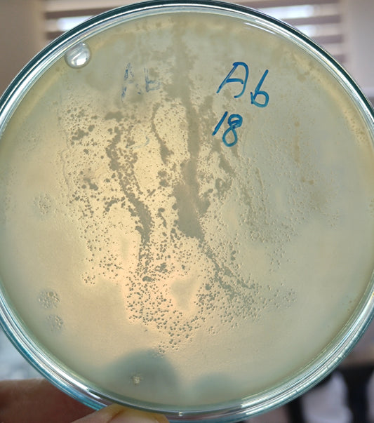 Acinetobacter baumannii bacteriophage 120018A