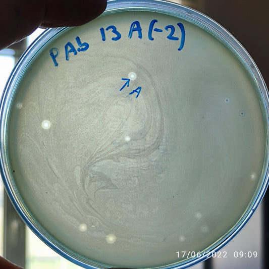 Acinetobacter baumannii bacteriophage 120013A