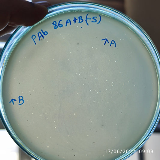Acinetobacter baumannii bacteriophage 120086B