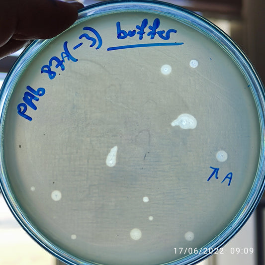 Acinetobacter baumannii bacteriophage 120087A