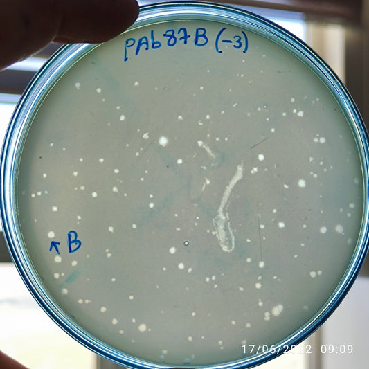 Acinetobacter baumannii bacteriophage 120087B
