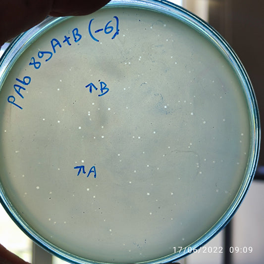 Acinetobacter baumannii bacteriophage 120089B