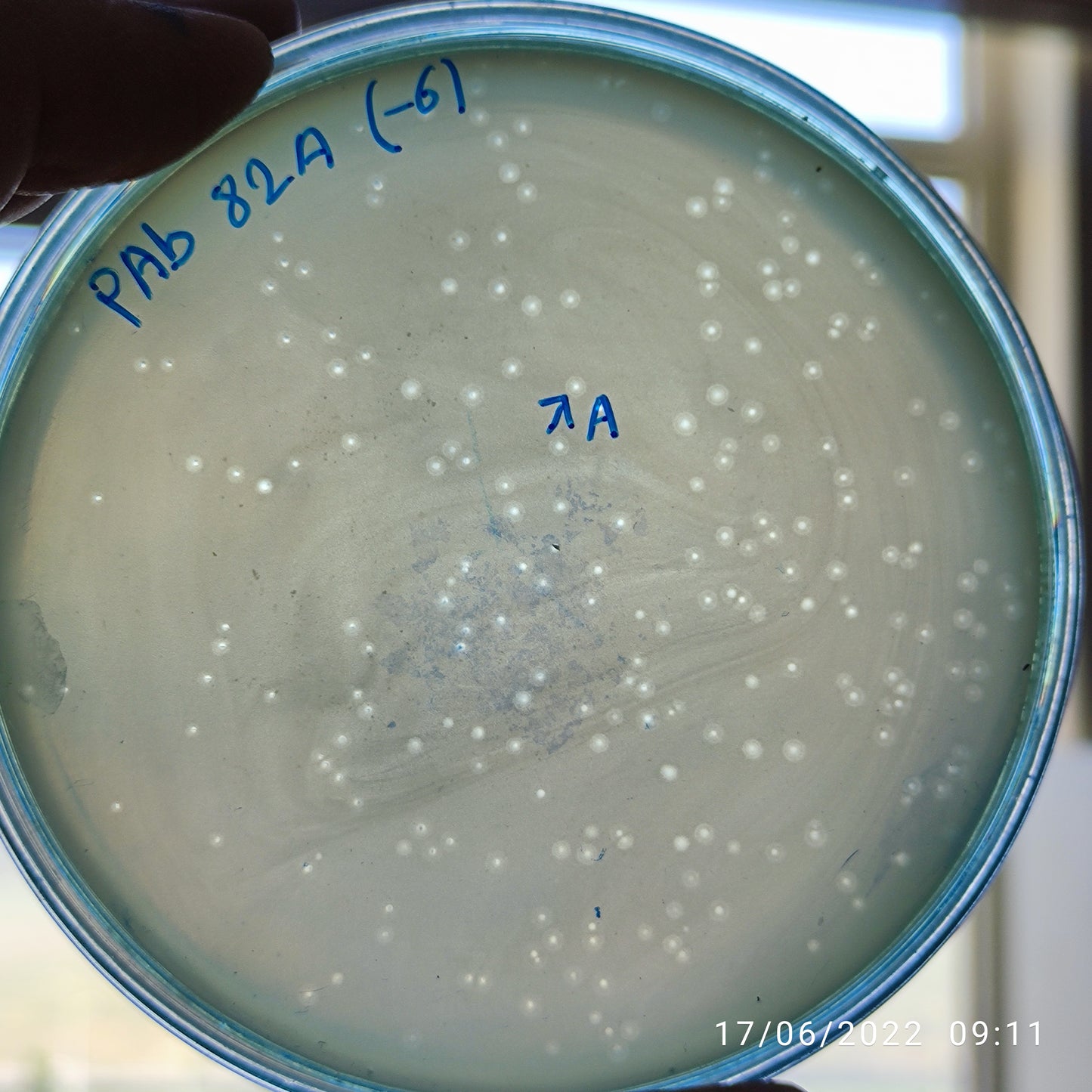 Acinetobacter baumannii bacteriophage 120082A