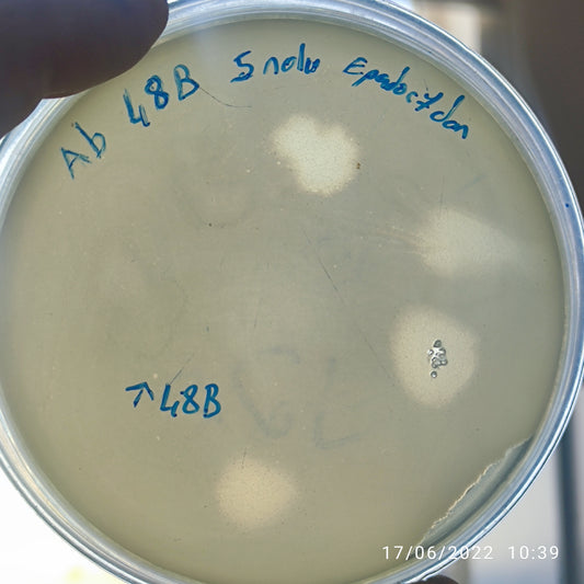 Acinetobacter baumannii bacteriophage 120048B