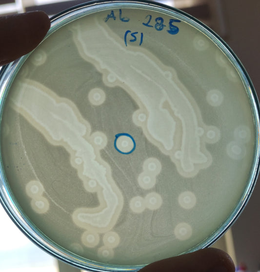 Acinetobacter baumannii bacteriophage 120285A