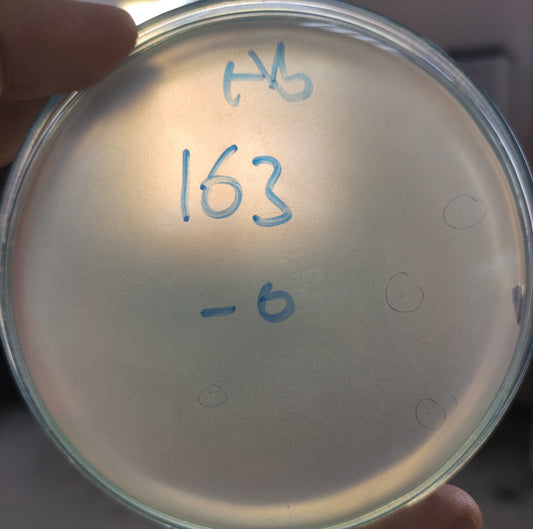 Acinetobacter baumannii bacteriophage 120163A