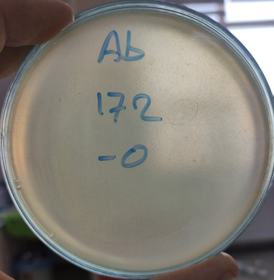 Acinetobacter baumannii bacteriophage 120172A