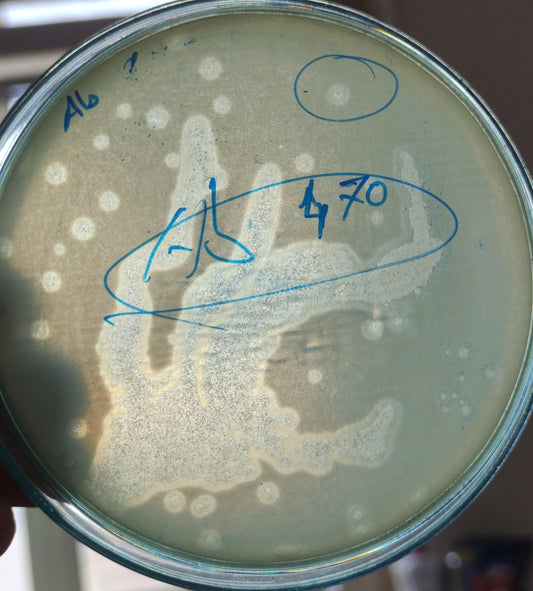 Acinetobacter baumannii bacteriophage 120470A