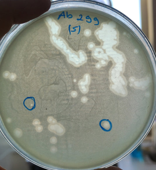 Acinetobacter baumannii bacteriophage 120299A