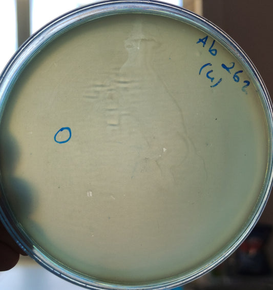Acinetobacter baumannii bacteriophage 120262A
