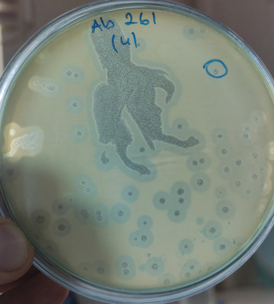 Acinetobacter baumannii bacteriophage 120261A