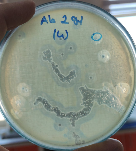 Acinetobacter baumannii bacteriophage 120291A