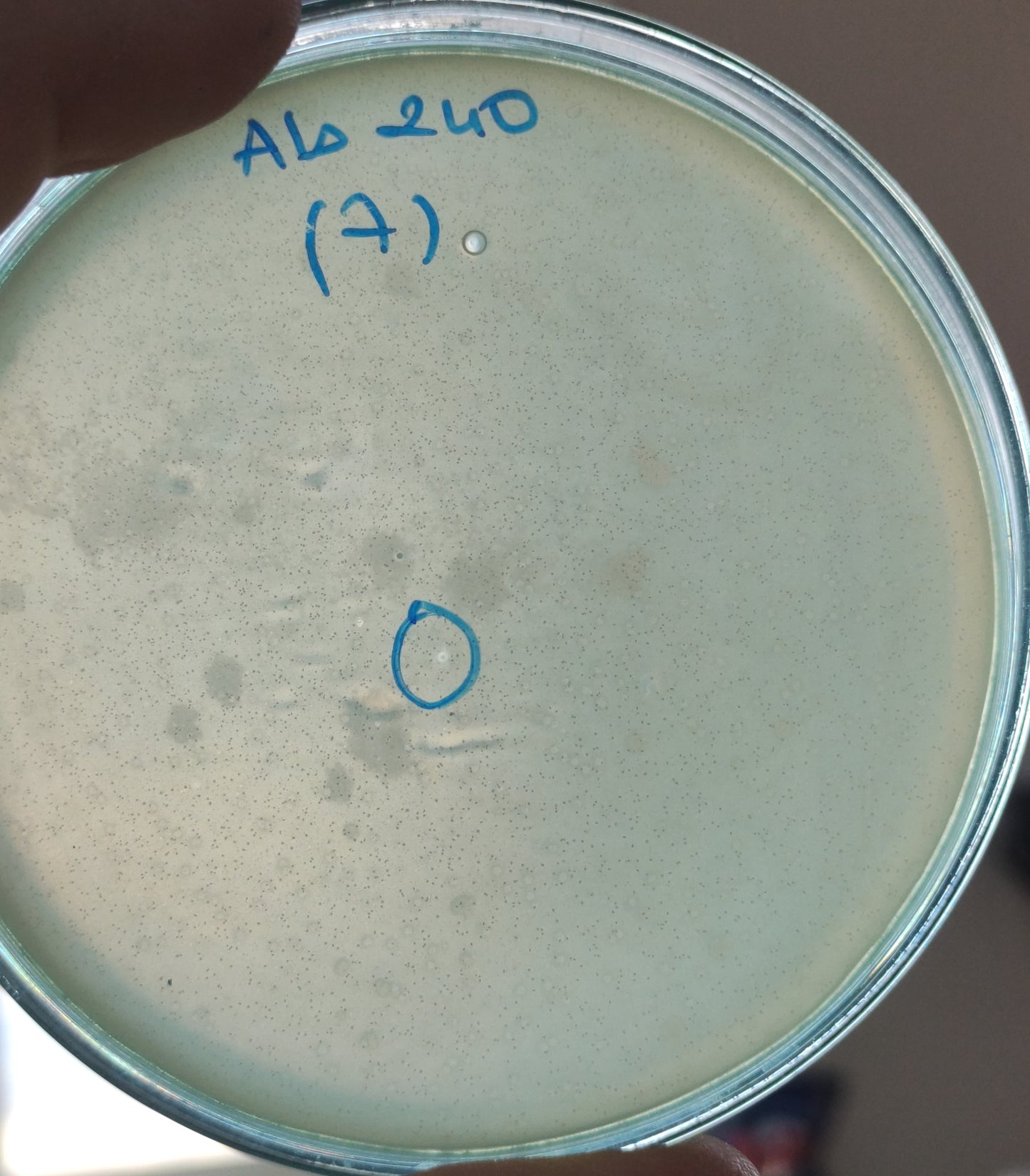 Acinetobacter baumannii bacteriophage 120240A