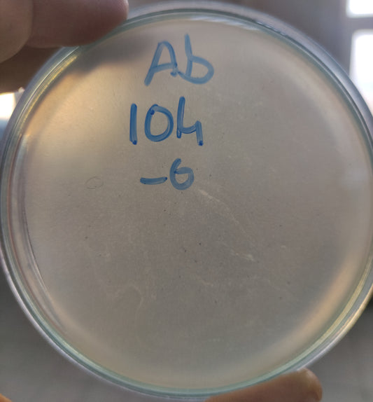 Acinetobacter baumannii bacteriophage 120104A