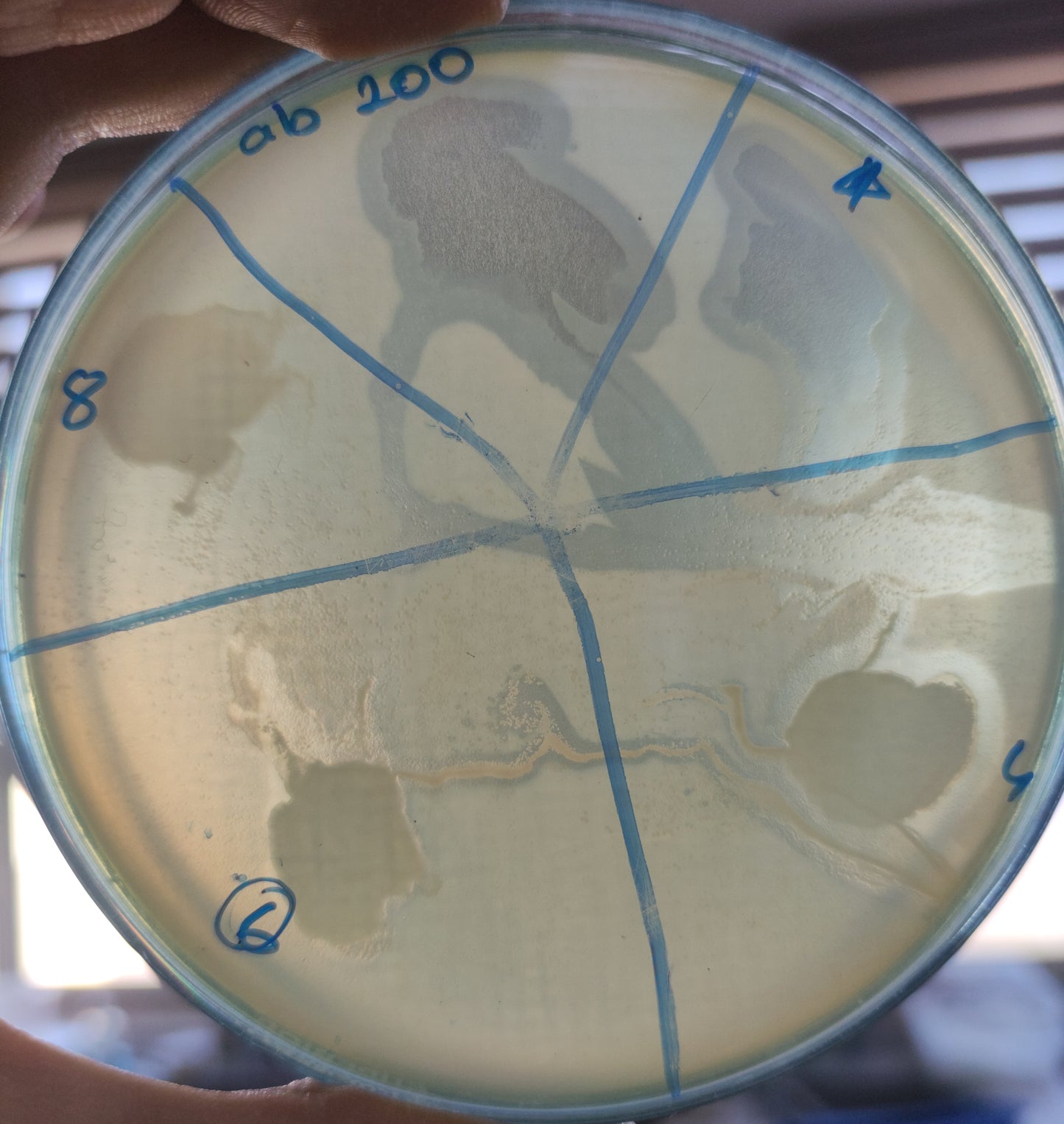 Acinetobacter baumannii bacteriophage 120200A