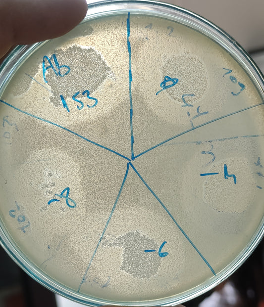 Acinetobacter baumannii bacteriophage 120153A