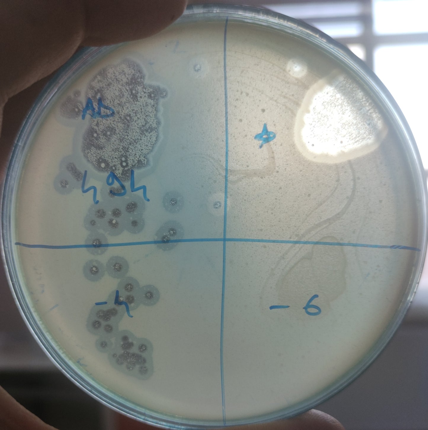 Acinetobacter baumannii bacteriophage 120494A