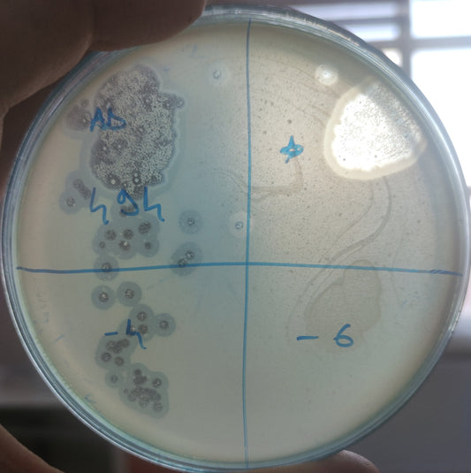 Acinetobacter baumannii bacteriophage 120494A